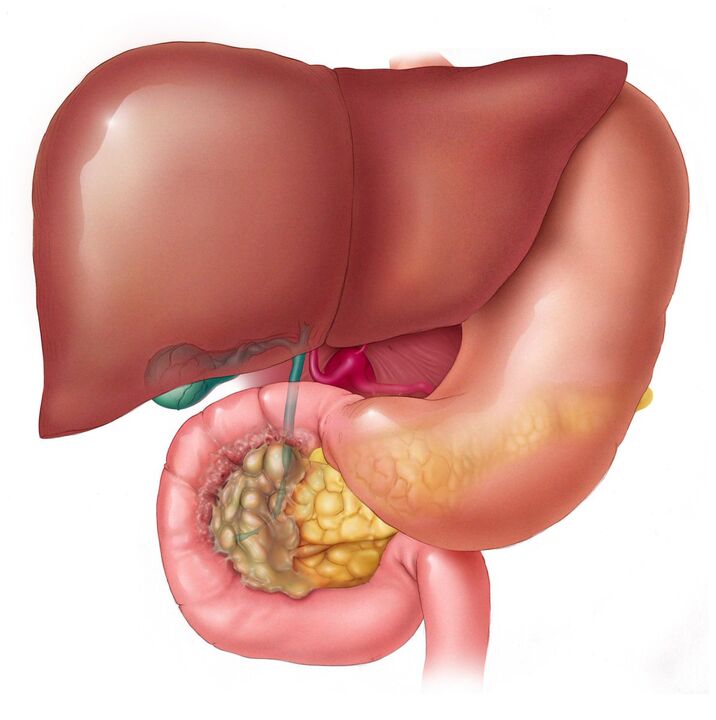 How to eliminate parasites from the liver
