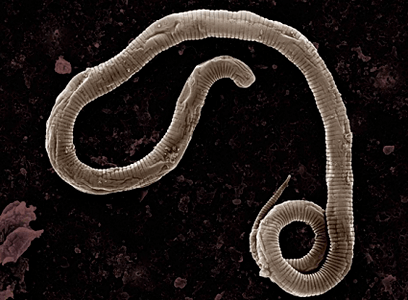 Where are the worms in the human body