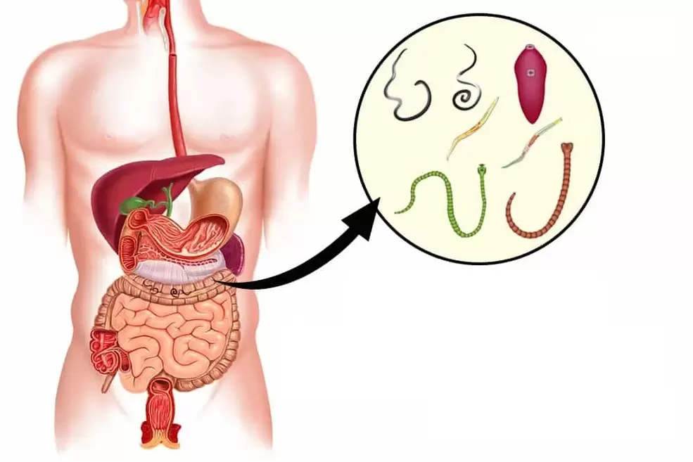 Worms in the human body
