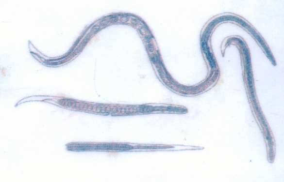 Guinea worms parasitic under the skin are very susceptible to infection